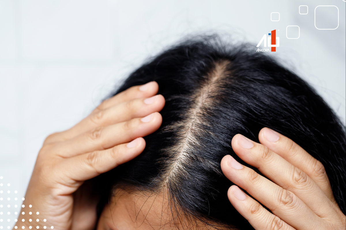 Descrição da imagem