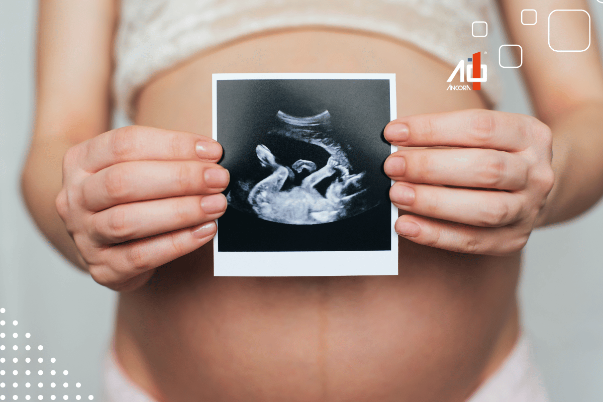 Descrição da imagem