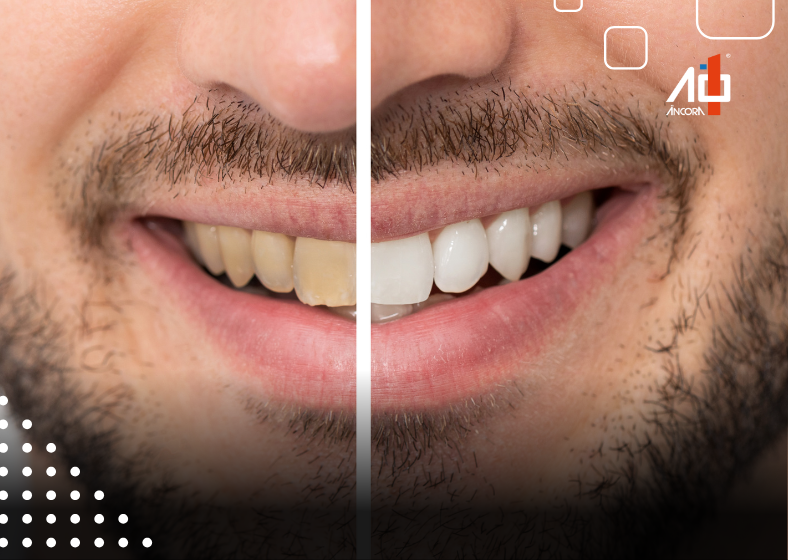 Descrição da imagem