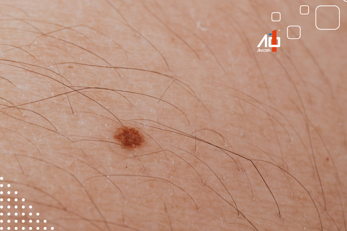 Descrição da imagem