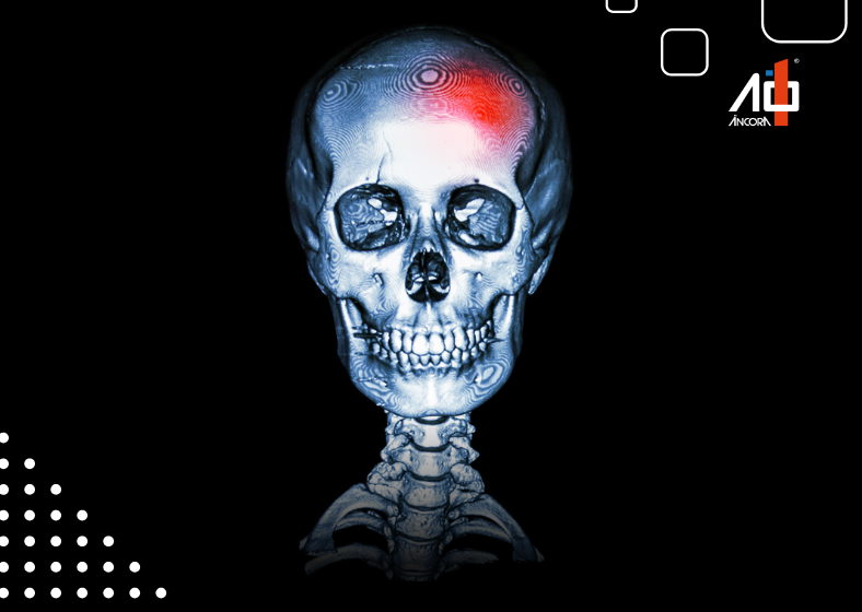 Descrição da imagem