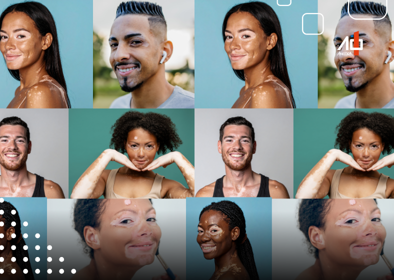 Convivendo com o vitiligo: data mundial traz visibilidade à condição e ao respeito