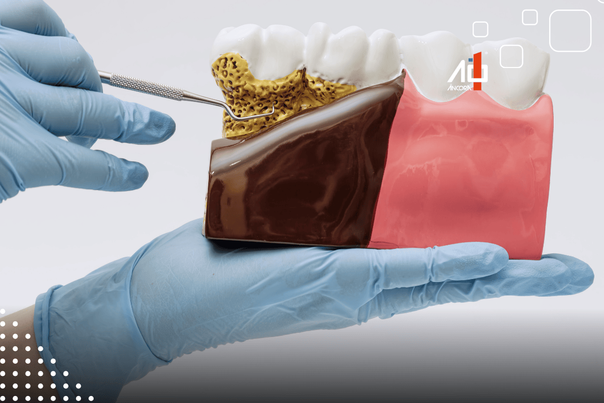 Descrição da imagem