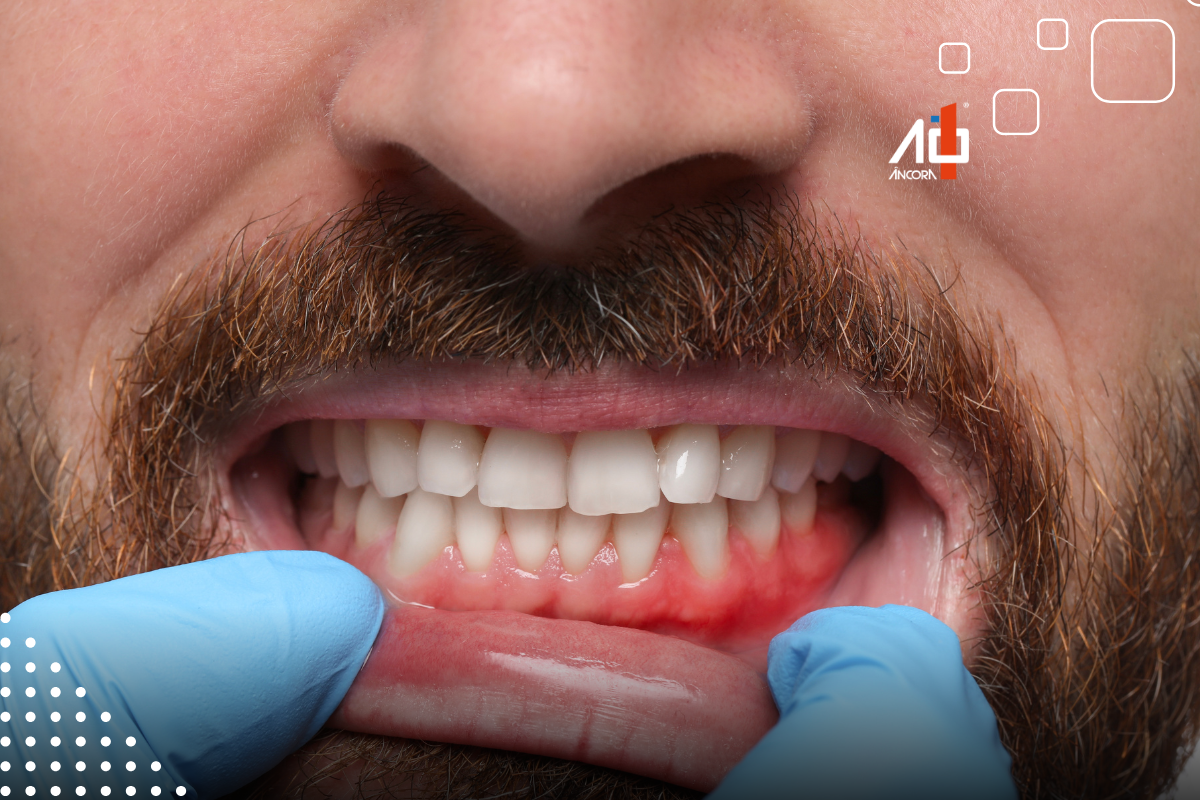 Descrição da imagem