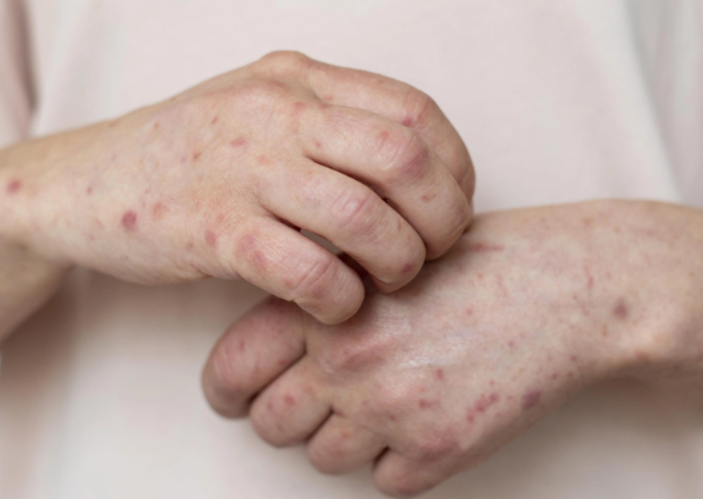 Descrição da imagem