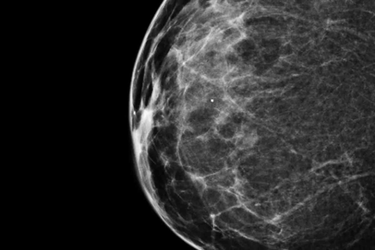 Descrição da imagem