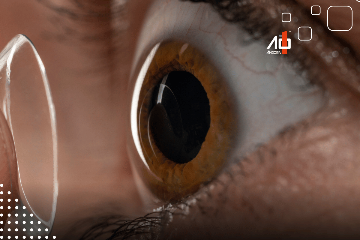 Descrição da imagem