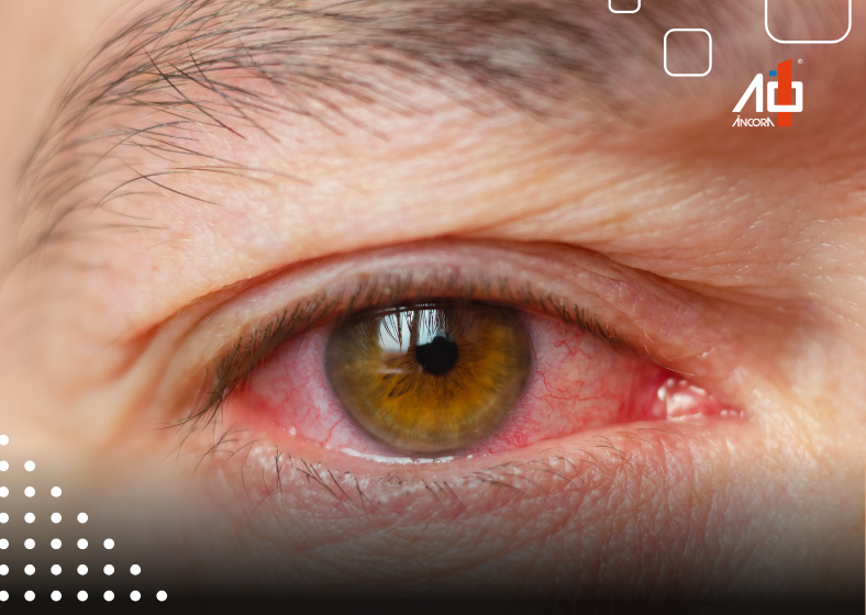 Descrição da imagem