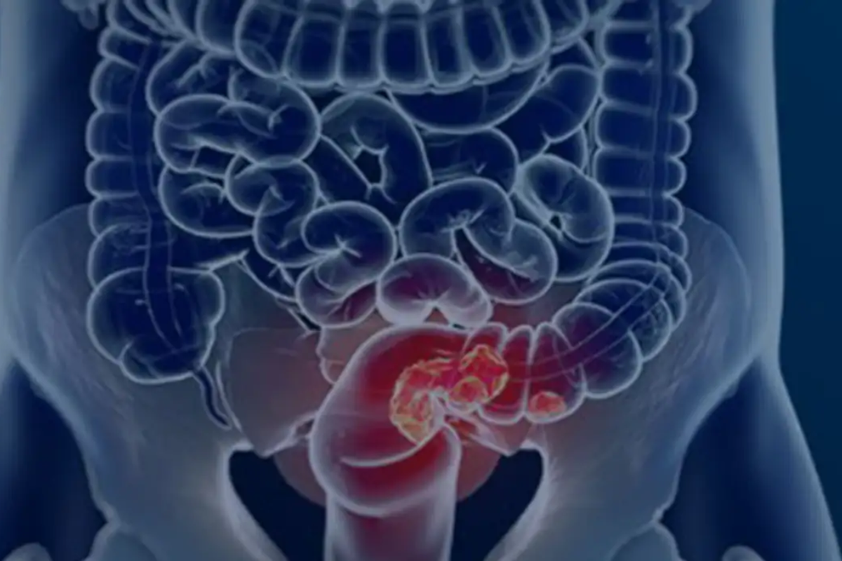 Descrição da imagem