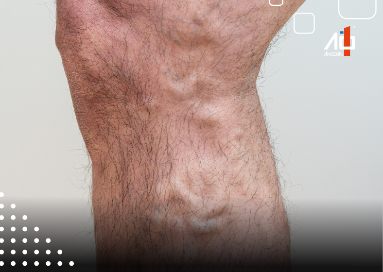 Descrição da imagem