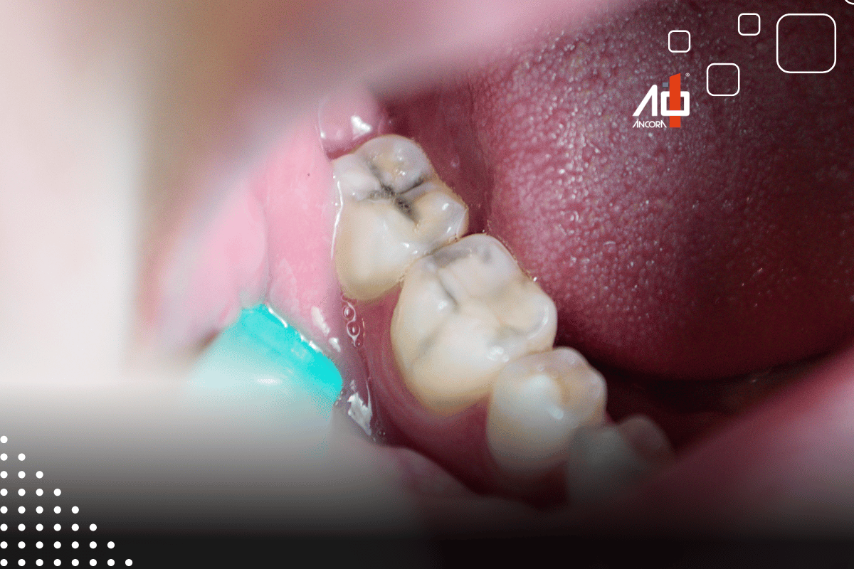 Descrição da imagem