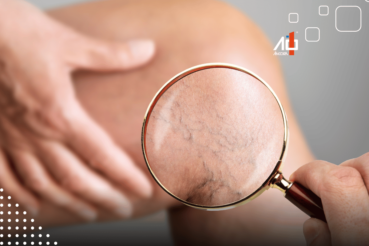 Descrição da imagem