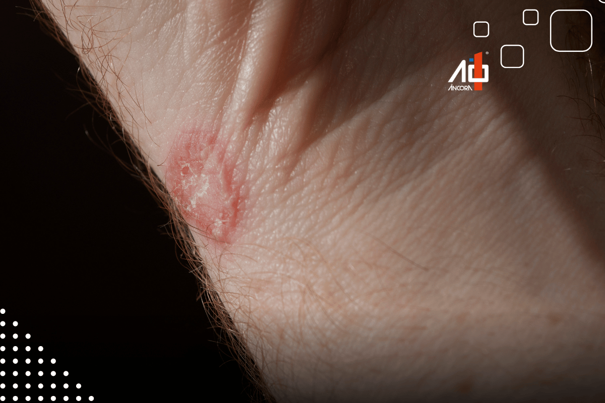 Descrição da imagem